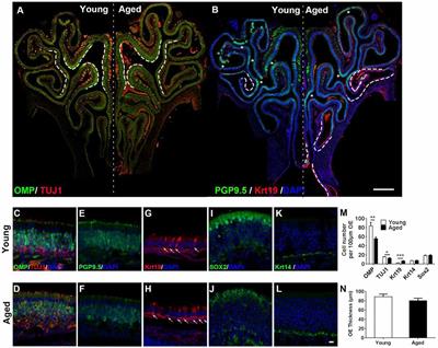Age-Dependent Activation and Neuronal Differentiation of Lgr5+ Basal Cells in Injured Olfactory Epithelium via Notch Signaling Pathway